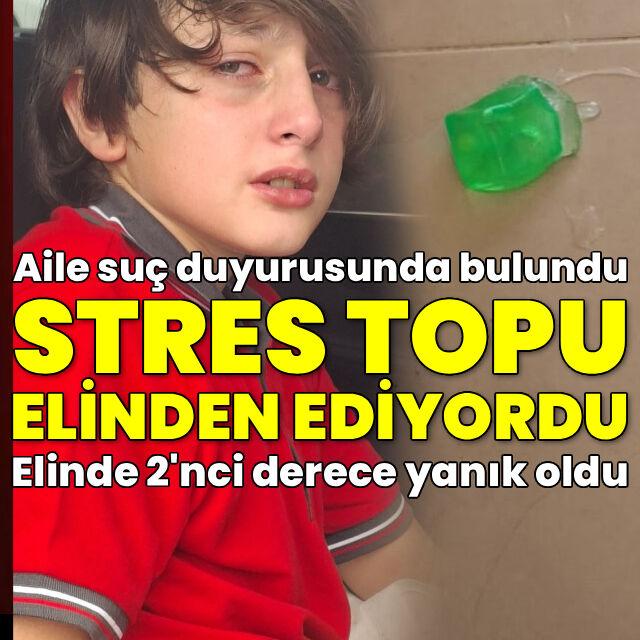 Stres oyuncağı elinde patladı! Yanık ve kızarık oldu