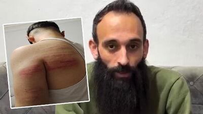 Berber şiddeti! 2 çırağını demir sopayla dövdü