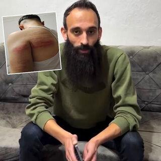 Berber şiddeti! 2 çırağını demir sopayla dövdü