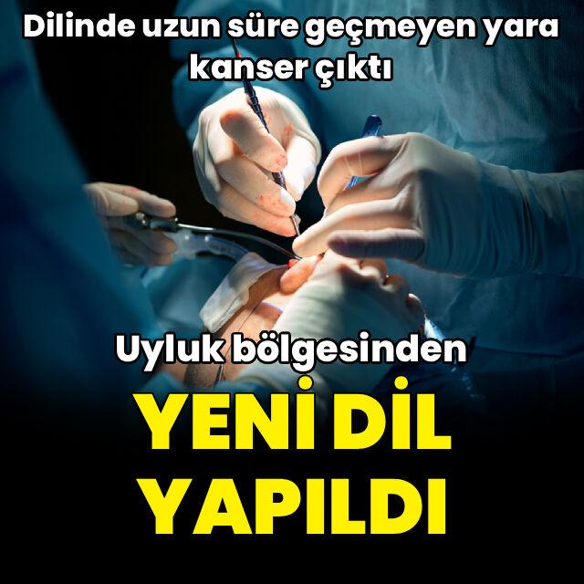 Dil kanseri olan hastaya uyluk bölgesinden yeni dil yapıldı