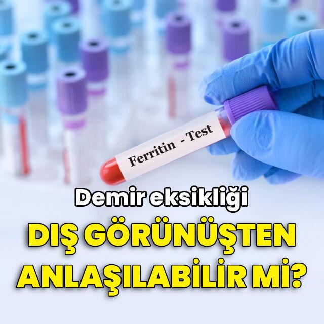 Demir eksikliği dış görünüşten anlaşılabilir mi?